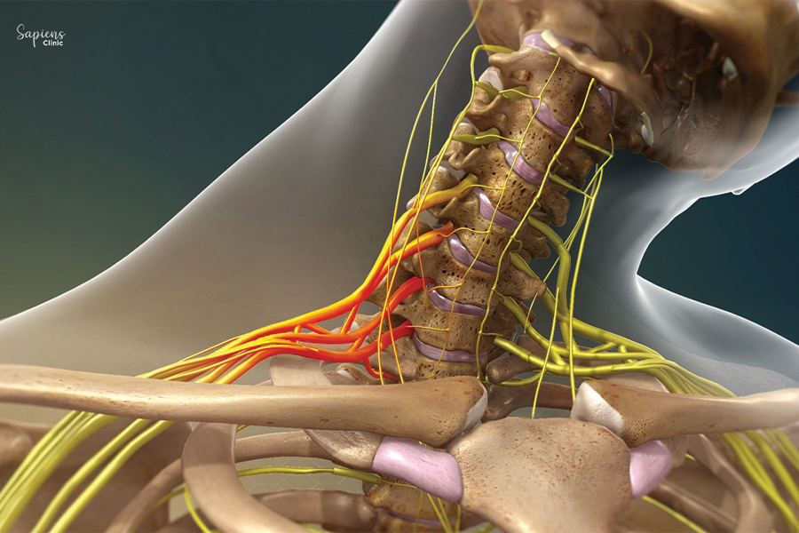 Hope After Brachial Plexus Injury: Advances in Treatment and Healing