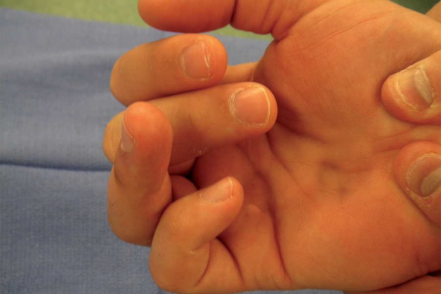Understanding Joint Transfer Procedures: When and How They Are Performed