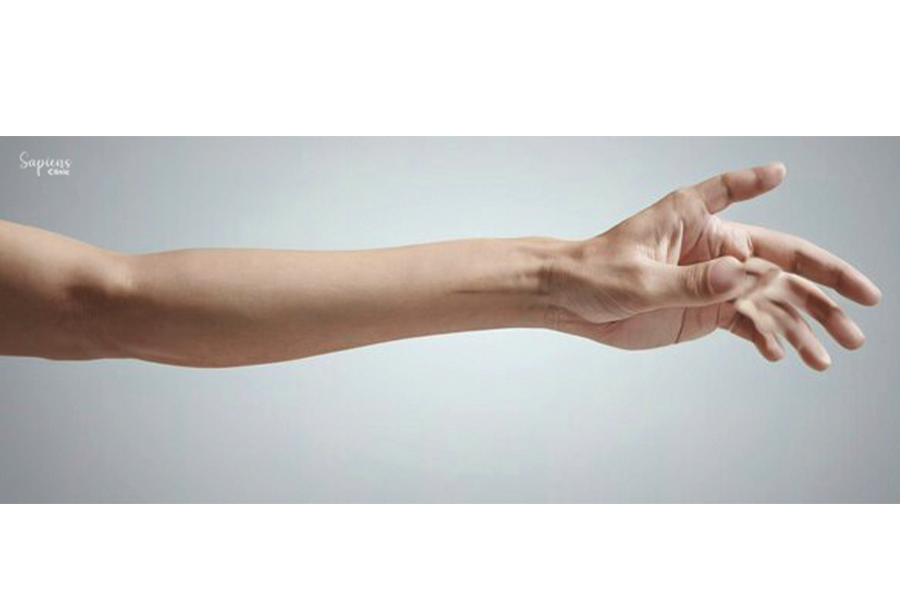 Dealing with Work-Related Upper Limb Disorders: How to Get Relief and Recover